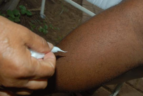 Campanha de combate à hanseníase acontece em janeiro