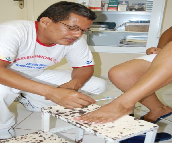 Técnicos do Departamento de Saúde Coletiva no Combate à Tuberculose